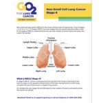 Click here for more information about Stage IV Non-Small Cell Lung Cancer (ID:1408)